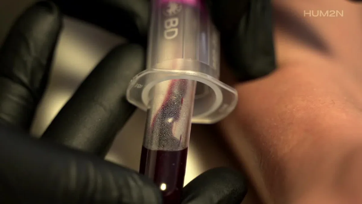 Blood sample being collected during a HUM2N clinic assessment